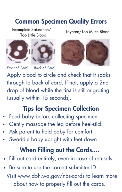 NBS specimen collection