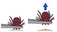 Use tweezers to pull out an attached tick.